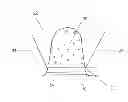 Fig. 01 - Non-resorbable plugs