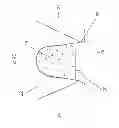 Fig. 04 - Non-resorbable plugs