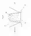 Fig. 05 - Non-resorbable plugs