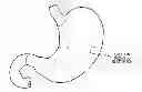 Fig. 01 - APPARATUS AND METHOD FOR TREATING OBESITY USING NEUROTOXINS IN CONJUNCTION WITH BARIATRIC PROCEDURES