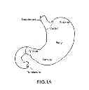 Fig. 02 - APPARATUS AND METHOD FOR TREATING OBESITY USING NEUROTOXINS IN CONJUNCTION WITH BARIATRIC PROCEDURES