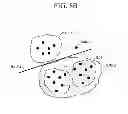 Fig. 13 - Apparatus and method of diagnosing a lesion using image data and diagnostic models