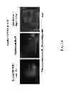 Fig. 23 - Generation of autologous T-cells in mice