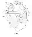 Fig. 02 - Protective headgear assembly