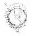Fig. 04 - Protective headgear assembly