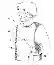 Fig. 01 - VEST ASSEMBLY