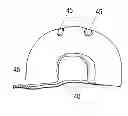 Fig. 01 - Portable diaper-changing restraint system