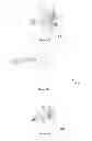 Fig. 18 - Elastic articulation for horological assembly