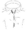Fig. 01 - Fastening system, in particular as a button or closure substitute