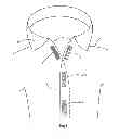 Fig. 02 - Fastening system, in particular as a button or closure substitute