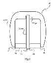 Fig. 02 - Fastening device suitable for use with needle detectors