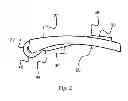 Fig. 03 - Fastening device suitable for use with needle detectors