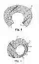 Fig. 04 - Method of making self-supporting insulating end cone liners and pollution control devices