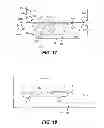 Fig. 14 - Applying heating liquid to remove moistening liquid