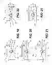 Fig. 09 - Pivoting thumb stop system and method