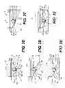 Fig. 11 - Pivoting thumb stop system and method