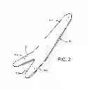 Fig. 03 - Drywall repair kit