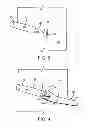 Fig. 04 - Drywall repair kit