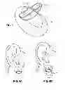 Fig. 03 - Earring support device