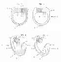 Fig. 02 - Jewelry article