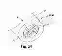 Fig. 16 - Prechamber ignition system