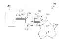 Fig. 01 - Patient cassette with variable patient circuit volume