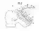 Fig. 04 - Expandable Inter Vivos Tube