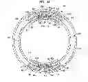 Fig. 05 - Expandable Inter Vivos Tube