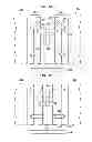 Fig. 08 - Expandable Inter Vivos Tube