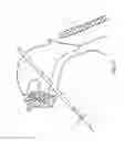 Fig. 16 - Method and apparatus for treating obstructive sleep apnea (OSA)