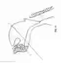 Fig. 19 - Method and apparatus for treating obstructive sleep apnea (OSA)