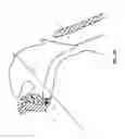 Fig. 20 - Method and apparatus for treating obstructive sleep apnea (OSA)