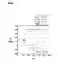Fig. 04 - High strength galvanized steel sheet and method for manufacturing the same