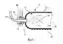 Fig. 04 - METHOD FOR FIBRE PLACEMENT WITH THE AID OF A TEMPERATURE-REGULATED ROLLER