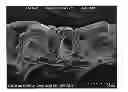 Fig. 01 - Stretchable Nonwoven Materials