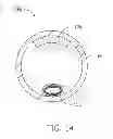 Fig. 15 - Flat heat pipe