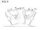 Fig. 07 - Radially embedded permanent magnet rotor and methods thereof