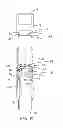 Fig. 09 - Tool and method for fracturing a wellbore