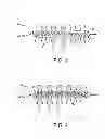 Fig. 04 - Radiofrequency absorptive filter