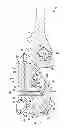 Fig. 07 - Methods and system for lubrication pressure relief for a roller cone drill bit