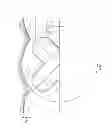 Fig. 09 - Stabilizing members for fixed cutter drill bit