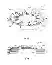 Fig. 02 - Bearing assemblies and apparatuses including tilting superhard bearing elements, and motor assemblies using the same