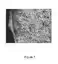 Fig. 04 - Sensors and sensor housing systems