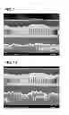Fig. 07 - Copper electrodeposition in microelectronics