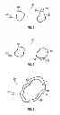 Fig. 03 - Radiofrequency particle separator