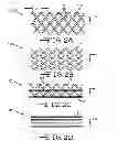 Fig. 03 - Wire screen with flattened wire
