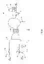Fig. 04 - Hemodialysis systems and methods