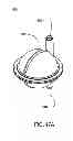 Fig. 110 - Hemodialysis systems and methods