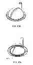 Fig. 113 - Hemodialysis systems and methods