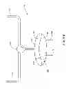 Fig. 18 - Hemodialysis systems and methods